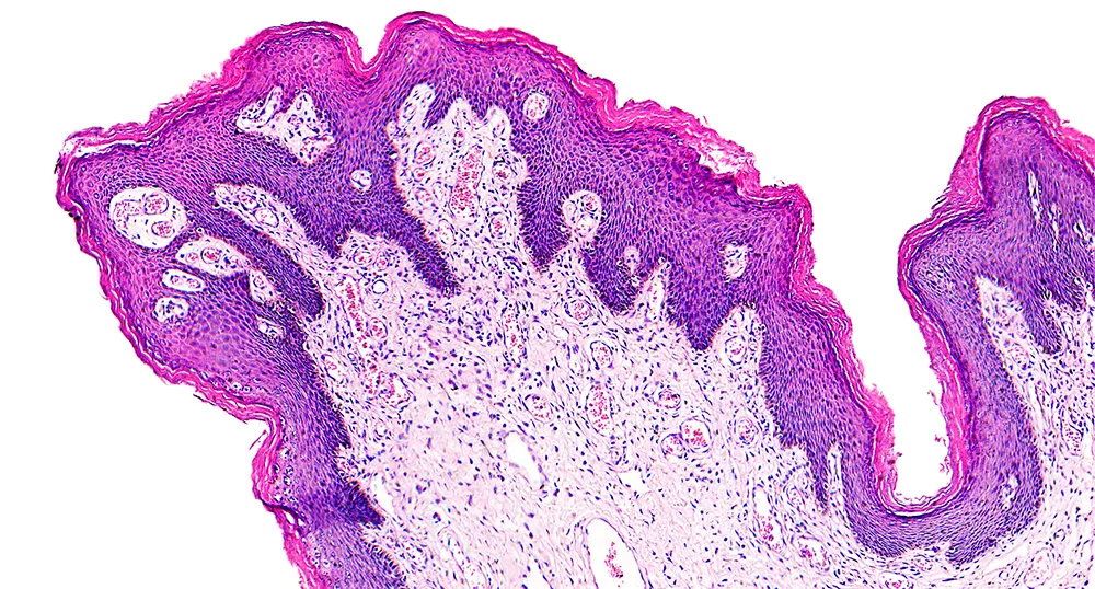 Pathology News Roundup: February 22, 2022