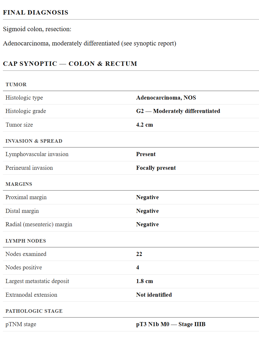 The finished surgical pathology report. A final diagnosis of sigmoid colon resection, adenocarcinoma moderately differentiated, followed by the full CAP synoptic for colon and rectum with every field carrying its value, including the negative proximal margin and a pathologic stage of pT3 N1b M0, stage IIIB.